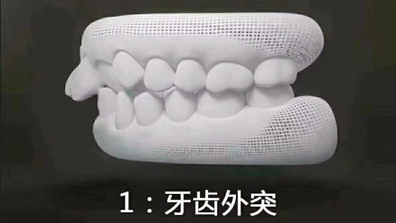 博韵口腔正畸合辑