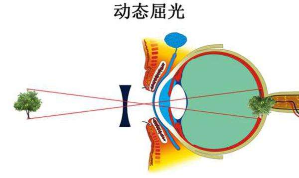 眼睛成像